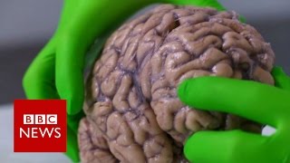 Up close with a human brain  BBC News [upl. by Pryce]