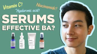 BEST SERUMS NIACINAMIDE VIT C HYALURONIC ACID  Effective ba My Personal Experience  Jan Angelo [upl. by Anam]