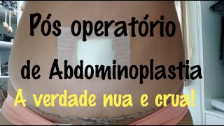 Pós operatório de Abdominoplastia lipoaspiração e enxerto de glúteo  dicas [upl. by Leakim794]