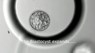 Blastocyst Development  Day 3 to Day 5 MUST SEE [upl. by Wanonah]