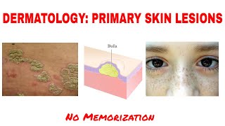 DERMATOLOGYPRIMARY SKIN LESIONS MACULE PATCH PAPULE PLAQUE VESICLE USMLE MCC CLINICAL MEDICINE [upl. by Arul]