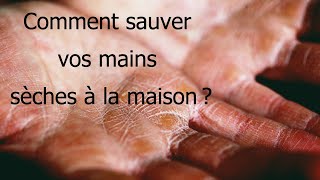 Comment sauver vos mains sèches à la maison  5 Méthodes efficaces [upl. by Balfour]