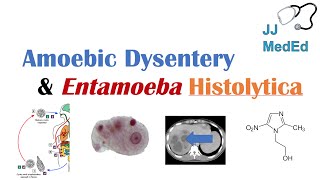 Amebiasis Amoebic Dysentery  Entamoeba histolytica Pathogenesis Signs amp Symptoms Treatment [upl. by Kellene]