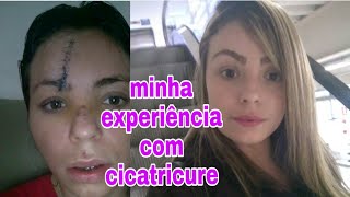 CICATRICURE FUNCIONA Minha experiência [upl. by Tallie]