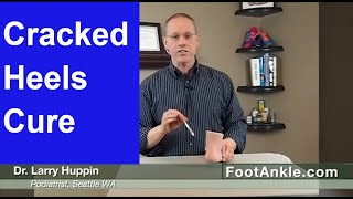 How to Treat Dry Cracked Heels with Seattle Foot Doctor Larry Huppin [upl. by Debo856]