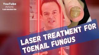 LASER treatment for toenail fungus shorts [upl. by Nnylrahc]