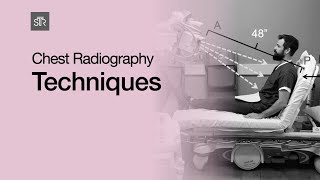 Chest Radiography Techniques [upl. by Melodie386]